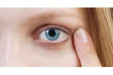 Çıban Çeşitleri Nelerdir?